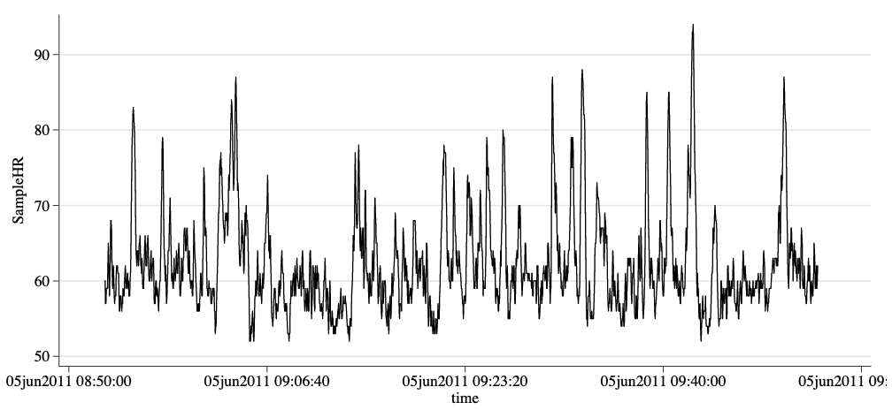 A graphic charting the heart rate of an episode over the course of one hour.